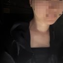 결혼 전 리프팅 준비! 내돈내산 울쎄라 프라임 후기 &amp; 효과 솔직 리뷰