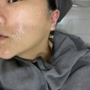 원주 기업도시피부샵 뷰티온 싸이블로 신부 웨딩관리 후기