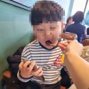 군산이비인후과의원 | 전주 김양박이비인후과 만5세 편도 비대 아데노이드 비대증 수술 후기