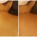 피부맑음 에스테틱 이미지