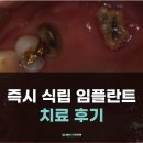 늘봄플란트치과 이미지