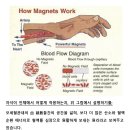 자석은 혈액순환제,﻿? 이미지