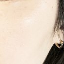 김화영피부샵 | 광주남구피부관리샵 김화영스킨케어 고주파 관리 받고 온 솔직 후기