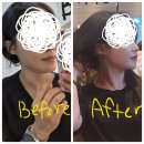캔버스범계역점 | 인생 첫 볼뉴머, 슈링크, 볼링크 리프팅 + 캔버스 범계역점 후기🌞 <한줄평 : 범계역은 좋은 곳이구나>