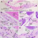 흰다리새우 치하 투명 PL병(TPD)의 중장 평활근의 괴사(midgut smooth muscle necorsis, MSMN) 이미지