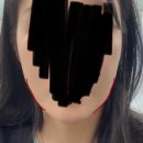 공장형피부과에서 울쎄라 100샷 불독살 시술! 비수면 고통 찐후기