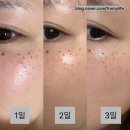 헤이민뷰티스튜디오 | [대구 피부 관리] 헤이민뷰티스튜디오(대구 주근깨/잡티/흑자)