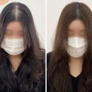 마음에점을찍다두피SMP 이미지