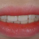 디엠치과기공소 이미지