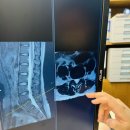 예반한의원 | 한의원에서 허리디스크 통증 진료 과정