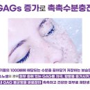 셀트
