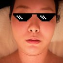 예쁜여우피부관리 | 위뷰티 예쁜얼굴 피부관리 후기, 얼굴윤곽관리로 느낀 발사지 효과