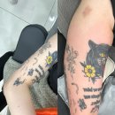 그날성형외과의원 | [롤리팝성형외과] 왼쪽 팔뚝 문신제거 1회차 후기(feat. 내돈내산)