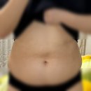 날씬의원 | 매일 상상했던 날씬한 몸매, 지방분해주사 의원 1회차 리얼 후기