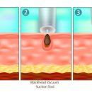 성화클리닉 이미지