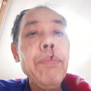 장이용소 이미지