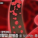 고혈압 낮추는 방법, 이것만은 꼭 알아두자! 이미지