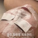 광주 화정동 피부관리 미의창조뷰티라인 아사필 후기