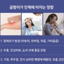 송학현대아파트 | [대치동 현대아파트] 구옥 내벽 탄성코트 시공 – 곰팡이, 균열, 결로 해결!