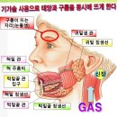 가슴 통증(02) 이미지