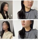 더웨이성형외과의원 | 강남역 온다리프팅 잘하는 곳 방문 후기