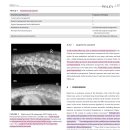 Articular process hyperplasia와 degenerative change의 임상 증상, 영상학적 특징 이미지