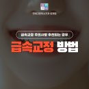 양재역치과 급속교정 방법 5가지 어떤 분께 필요할까요 주의사항