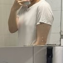 동양혈액순환연고 | 전신 지방흡입 3년차 후기｜팔, 허벅지, 복부 (가격, 회복기간, 부작용, 흉터 )