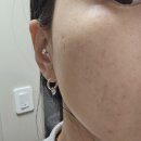 세보 | 피부장벽 개선 프롬힐 세보힐 세럼 사용후기