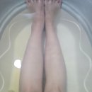 (주)조아폴리텍 | 반월상연골파열 수술 8-11주차