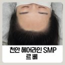 수헤어라인 | 천안두피문신 천안헤어라인 자연스러운 헤어라인후기 [르베REVE]