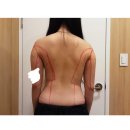 셀러브의원 | 팔 부유방 등 러브핸들 람스후기