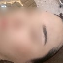 대덕2제 | 【대전 신탄진】 아티스트비에스 신탄진점 - 스킨플래닝 후기, 과정, 효과