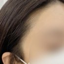 체인지헤어라인 이미지