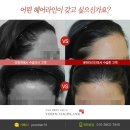 라인헤어 이미지