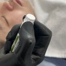 이남강변로 | [광주 첨단] 여드름 피부관리 _ &#39;프와&#39; :: 3회차 방문ㅣ스킨젝션프로로 피부 극복 후기