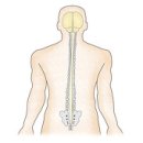 다발성 신경병증 (Polyneuropathy) 이미지