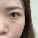 다비치안경 인하대점 | 용현동안경점 다비치안경 인하대점 난시 원데이렌즈 할인