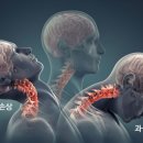 명가죽 이미지
