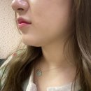 닥터케빈의원 | 안면윤곽 + 심부볼제거 + 이중턱주사 = 닥터케빈의원 강남 엄마찬스 후기!