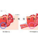 숨바로수면센터 이미지