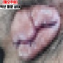 주식회사 모터원 | 수술해도 재발한 치질 치핵! 3주만에 극복한 방법 (모르면 X손해)