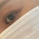 늘조은동물병원 | 분당피부과 리쥬란 쥬베룩 내돈내산 후기 통증 다운타임 판교