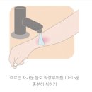 푸른 제주 | 제주 화상 병원: 제주푸른병원 치료 후기 및 화상 응급처치 꿀팁 (제주살이 중 비상사태!) 🏥
