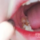 티스치과의원 이미지