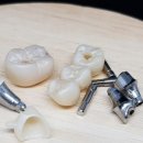 월드치과기공소 이미지