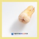 서울라미플란트치과교정과치과의원 이미지