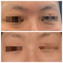 유라인에스테틱 - 경산시 성암로11길 19-2 | 경산 옥산동 유라인에스테틱, 유라인에스테틱 눈밑처짐관리후기, 유라인에스테틱모공관리후기.