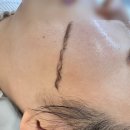 동수북로 | 꼼꼼한 시술 전문 인천 부평 세라링 스킨 플래닝 미러 왁싱 솔직 후기