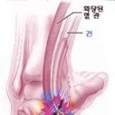 축구선수의 부상③발목터널증후군 이미지